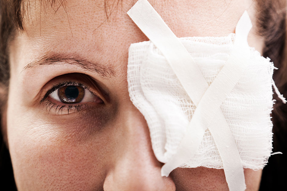 Woman with eye injuries, patch of taped gauze on eye